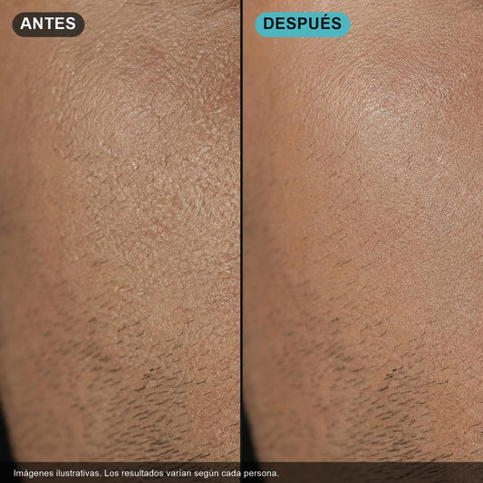 Antes y después: piel seca vs. piel hidratada (imágenes ilustrativas)