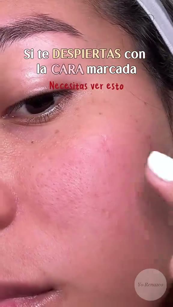 Así se ve en la piel