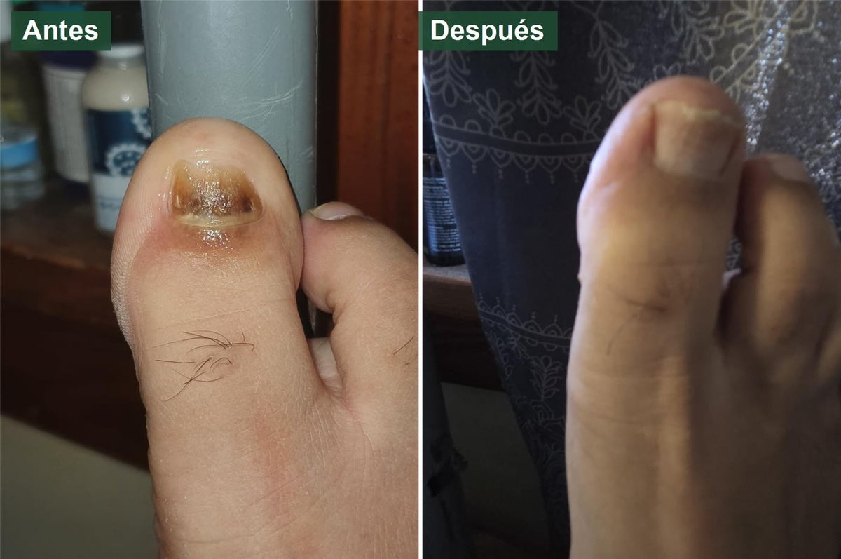 Antes y después real