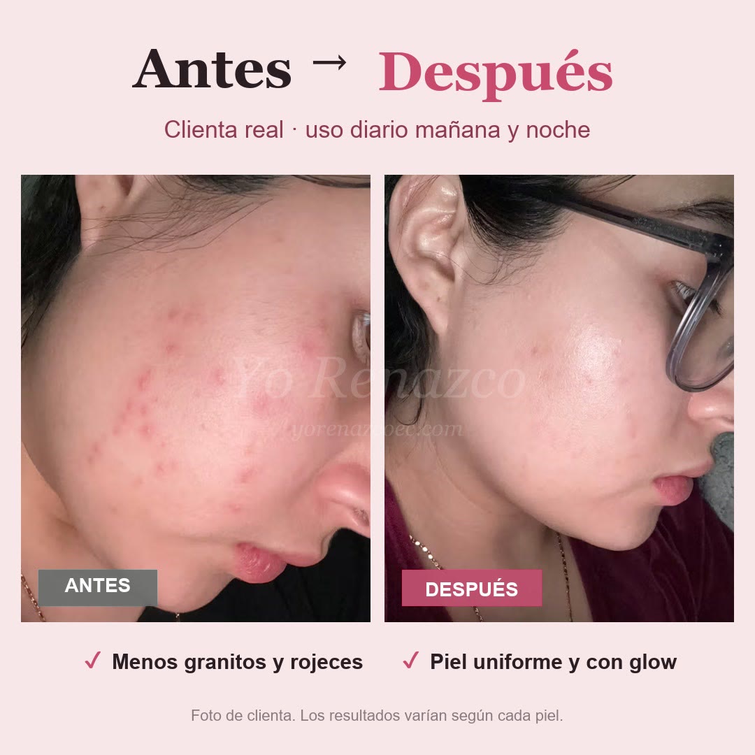 Sérum Rosado PDRN Medicube — Glow, hidratación y firmeza, skincare coreano (30 ml)