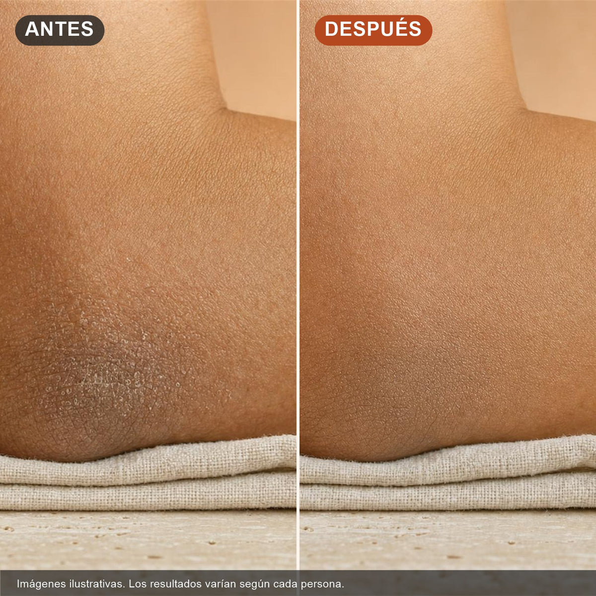 Antes y después en codo (imágenes ilustrativas)